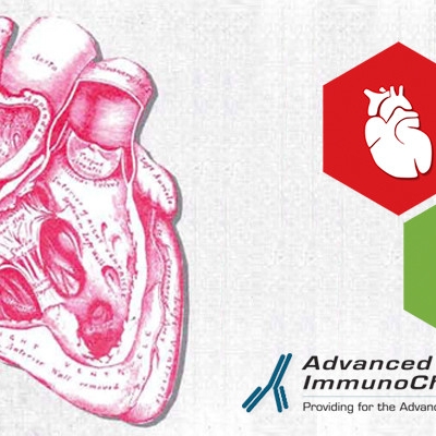 Recombinant Rb Cardiac Troponin I Antibodies (cTnI): targeted to epitope region 24-40 a.a.r. of cTnI.Recombinant Rb Cardiac Troponin I Antibodies (cTnI): targeted to epitope region 24-40 a.a.r. of cTnI.
