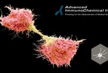 CA 72-4 marker: adjunct to conventional biomarkers in monitoring of pancreatic, ovarian and colorectal cancers.