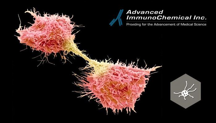 Hidden Persuasion Easy to understand CA 72-4 marker: adjunct to conventional biomarkers in monitoring of  pancreatic, ovarian and colorectal cancers. - Advanced ImmunoChemical  Inc.Advanced ImmunoChemical Inc.